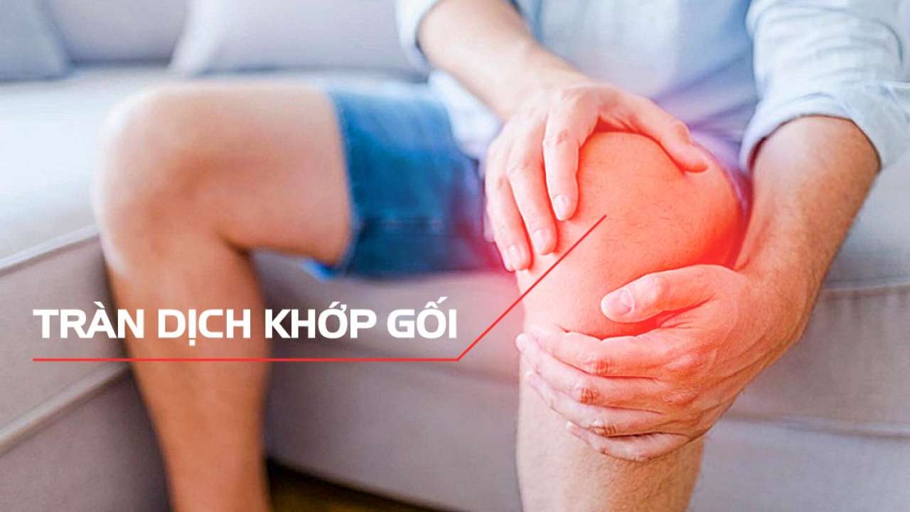 Viêm khớp gối có liên quan đến bệnh lý khác không?
