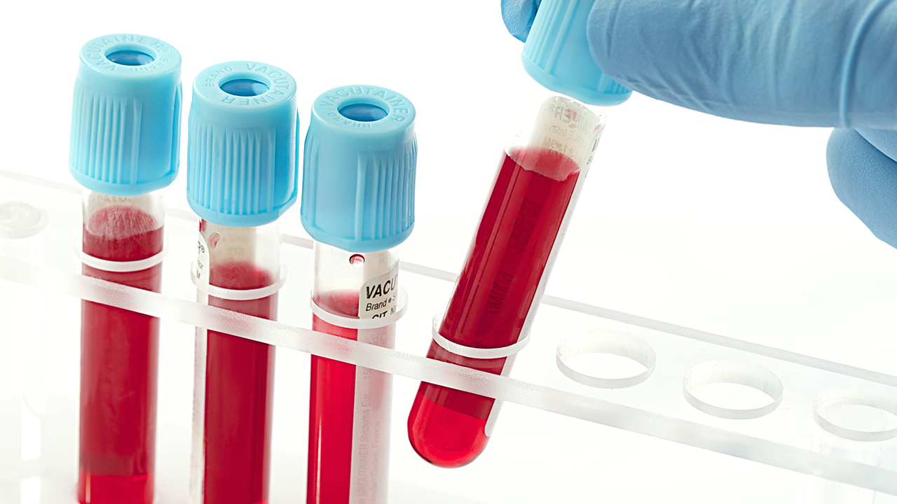 Có những chỉ số tầm soát ung thư dạ dày nào được sử dụng trong xét nghiệm máu?
