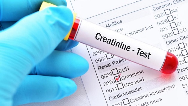 Creatinin là một trong các chỉ số xét nghiệm máu, kết quả của quá trình đào thải do thoái hóa creatin phosphat ở cơ