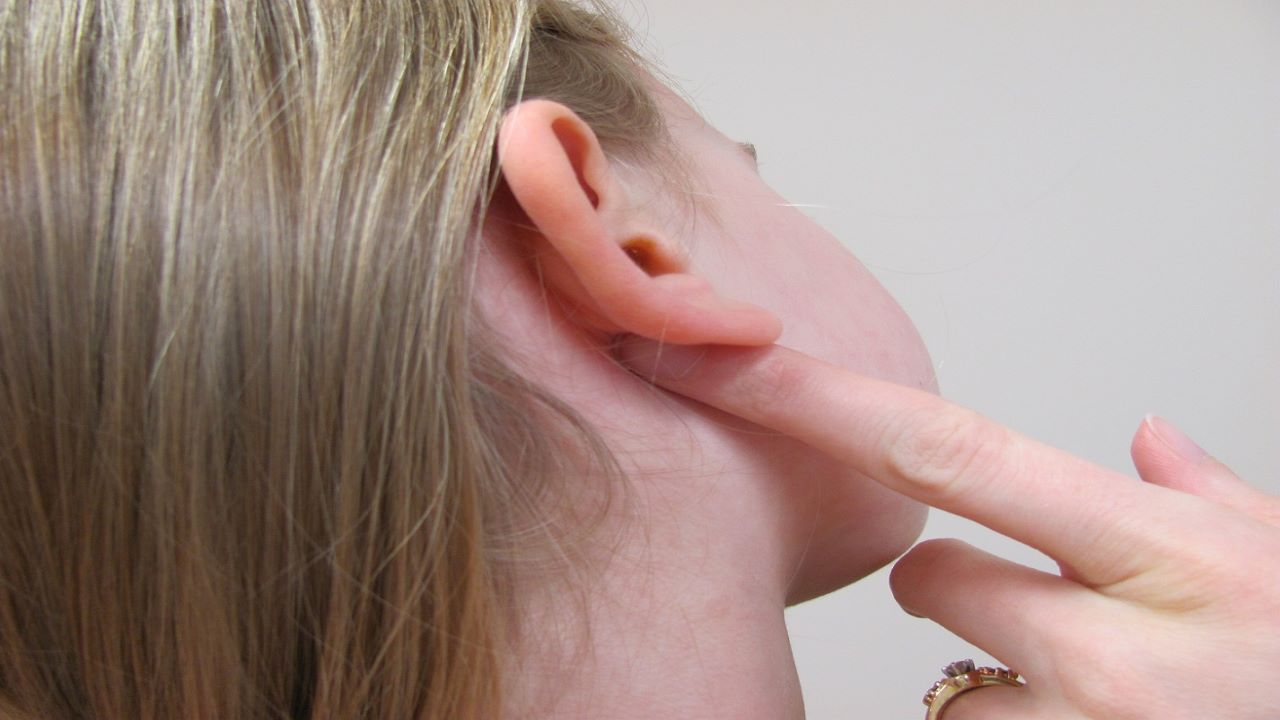 Nổi hạch ở mang tai là gì và có nguy hiểm không?