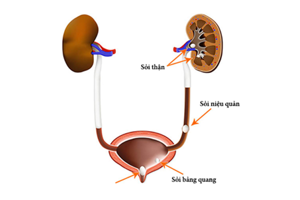 soi nieu quan doan sat thanh bang quang nam o vi tri 1.3 duoi