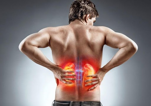 Triệu chứng của sỏi thận có thể là cơn đau vùng lưng lan xuống bụng và hạ vị