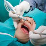 Trồng răng implant có đau không? Mất bao lâu hoàn thiện?
