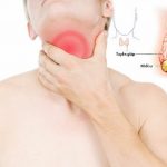 U tuyến giáp xâm lấn khí quản nguy hiểm thế nào?