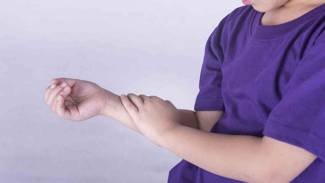 Viêm khớp dạng thấp ở trẻ em có triệu chứng như thế nào?