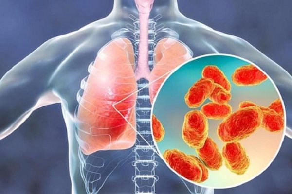 Bệnh alzheimer sống được bao lâu?