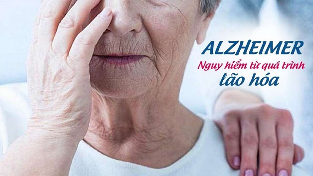 mối liên hệ giữ a bệnh mất trí nhớ Alzheimer và tuổi tác