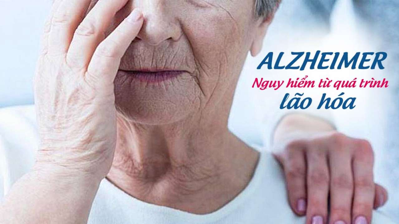 Bệnh mất trí nhớ Alzheimer nguy hiểm cỡ nào? | TCI Hospital