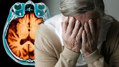 Tìm hiểu chi tiết triệu chứng bệnh Alzheimer