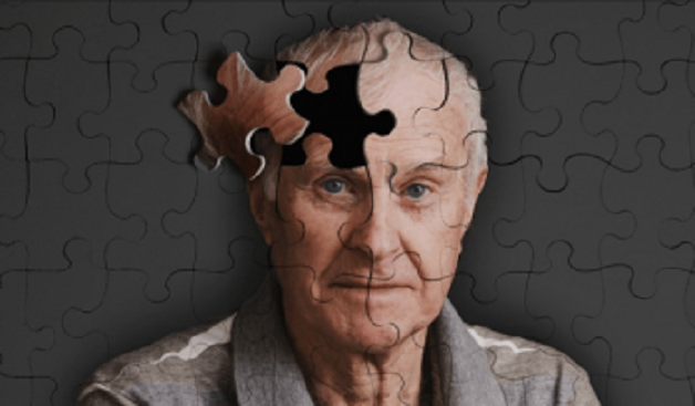 Triệu chứng của bệnh Alzheimer