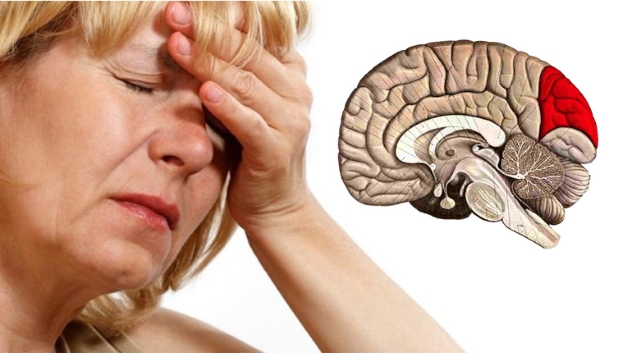 Nữ giới có tỷ lệ mắc bệnh đau đầu rối loạn tiền đình cao hơn so với nam giới.