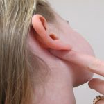 Nổi cục ở tai nguyên nhân do đâu?