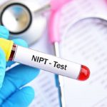 Giải đáp băn khoăn mẹ bầu: Có nên làm xét nghiệm NIPT không?