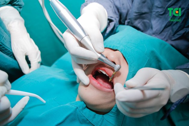 trồng răng sứ implant