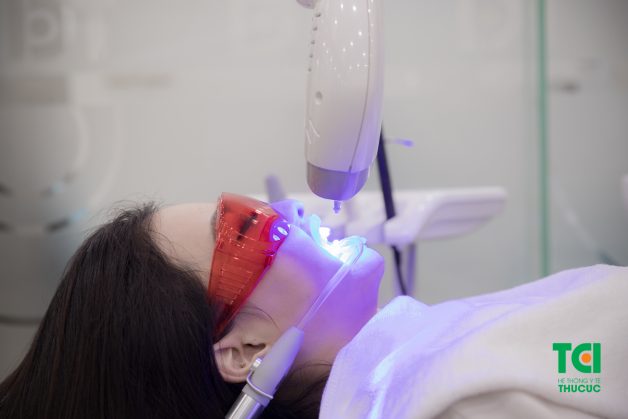 Tẩy trắng răng laser