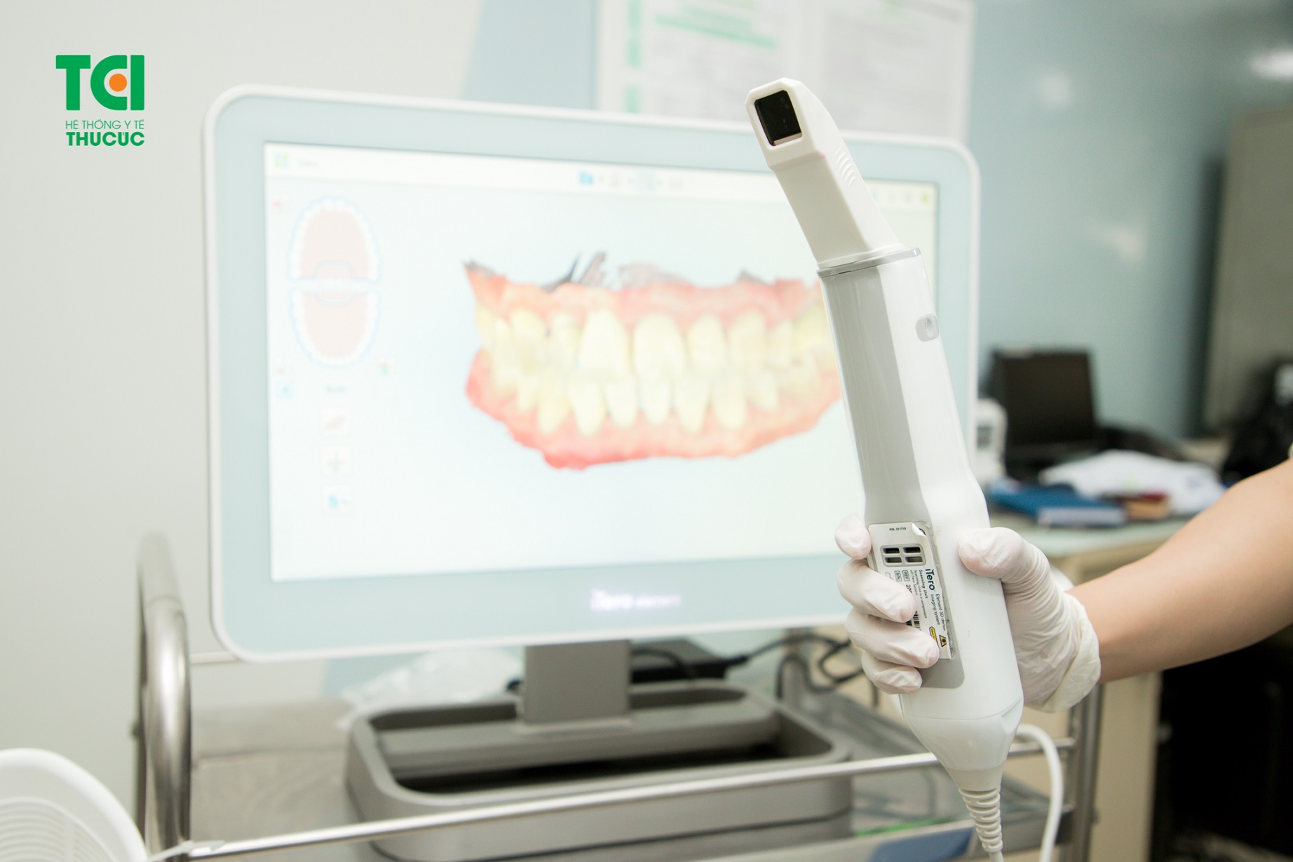 máy scan răng iTero 5D