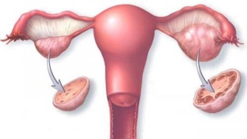 Vòi trứng thông hạn chế và khả năng mang thai của phụ nữ