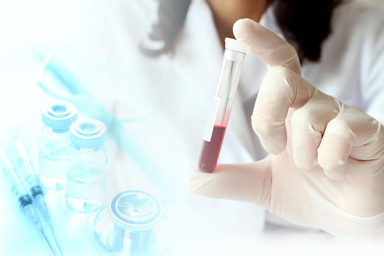 Làm thế nào để chuẩn bị cho xét nghiệm men gan GGT?