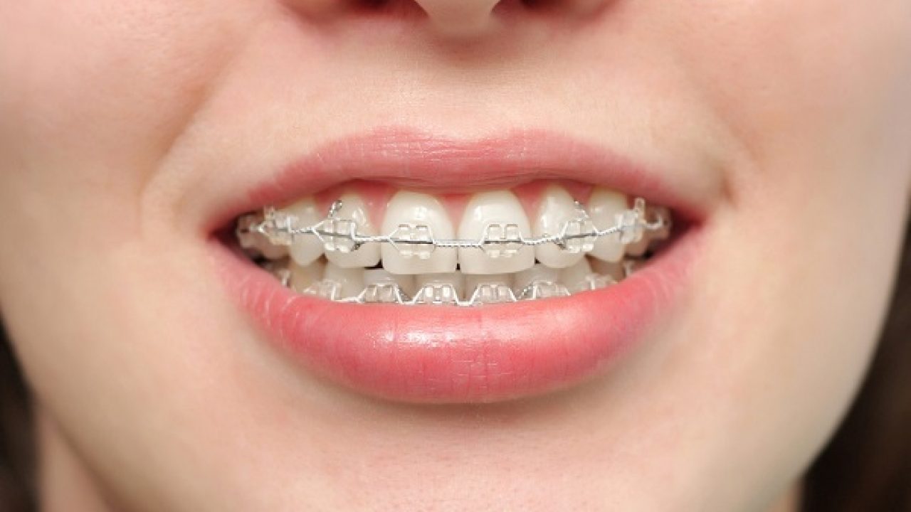 Hàm răng đều đẹp có tiềm năng giúp trẻ em và người lớn xây dựng tư thế tự tin và thành công trong cuộc sống?
