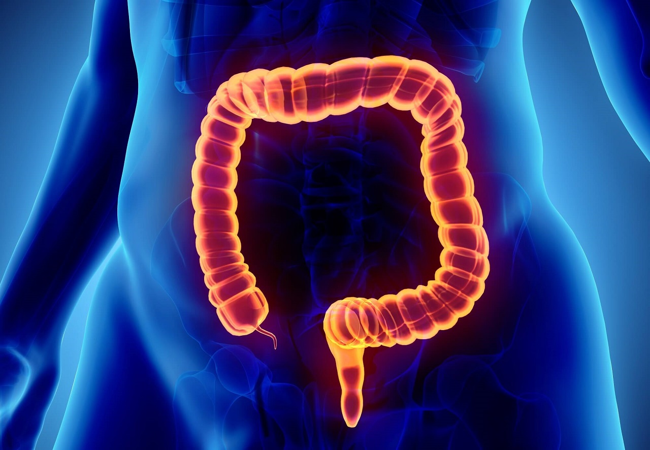 Đau ruột thừa ở đàn ông có thể lan từ đâu đến đâu trên bụng?
