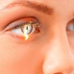 Bệnh Glaucoma cấp: Triệu chứng, chẩn đoán và cách điều trị