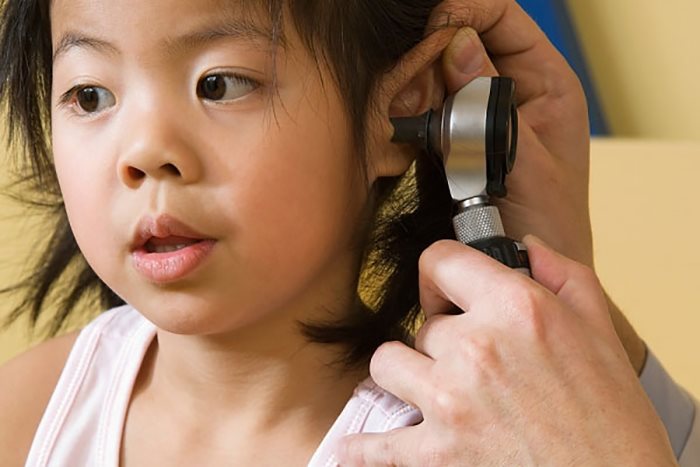 Viêm tai giữa là bệnh lý phổ biến ở trẻ