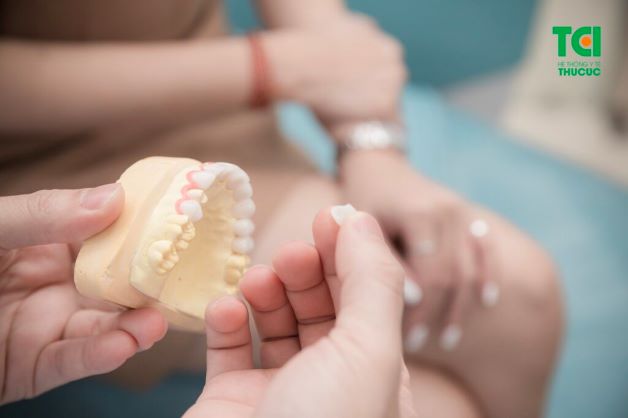 Một trong những nhược điểm của bọc răng sứ là phải mài răng thật để làm trụ răng nâng đỡ mão răng sứ, có thể gây xâm lấn tới răng thật.