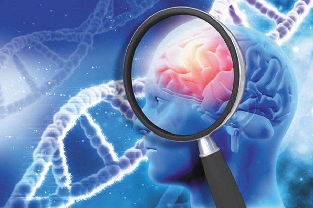Gen gây sa sút trí tuệ thuộc nhóm yếu tố nguy cơ không thể thay đổi