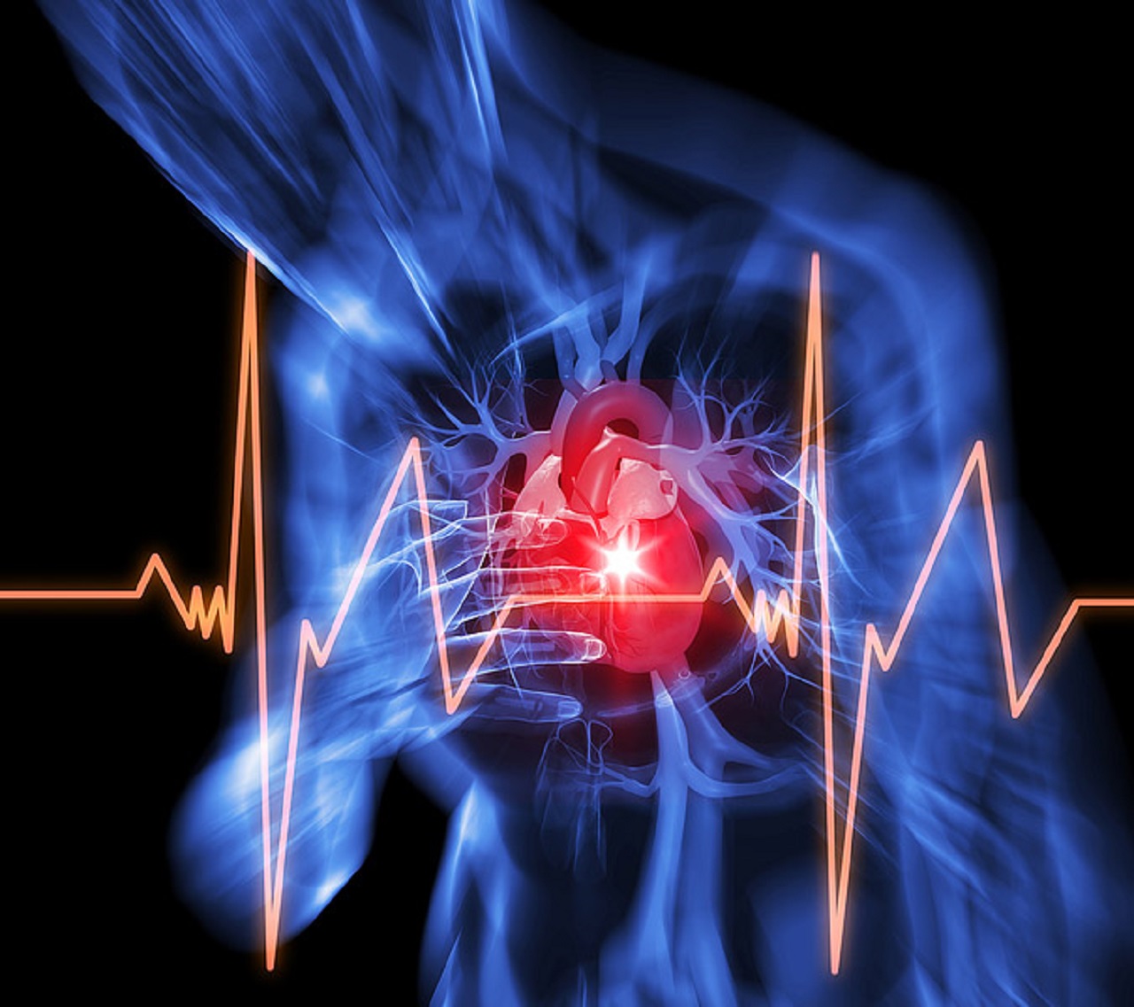 Liệu đột quỵ nhồi máu cơ tim có nguy hiểm không và có thể dẫn đến cái chết không?