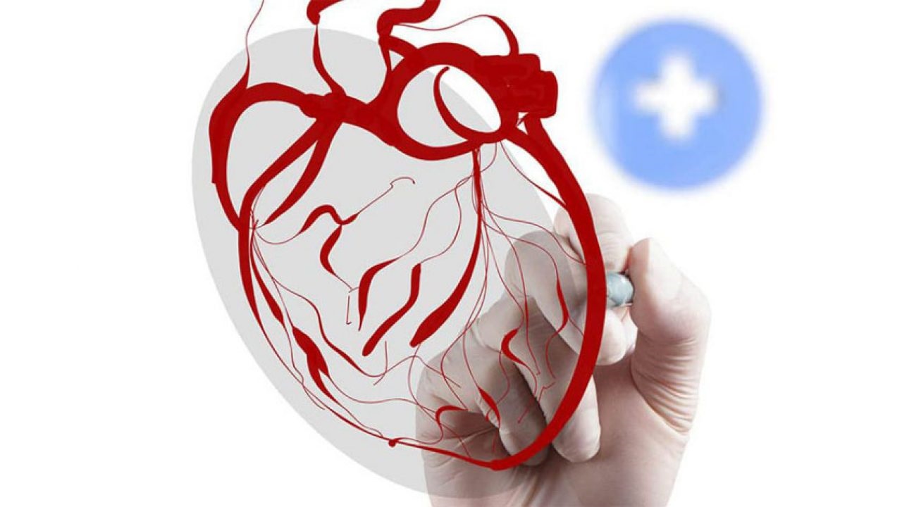 Chăm sóc bệnh giãn mạch vành tim đúng cách để tránh biến chứng