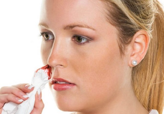 Số ít bệnh nhân nhạy cảm có thể bị chảy máu mũi, miệng sau khi nội soi
