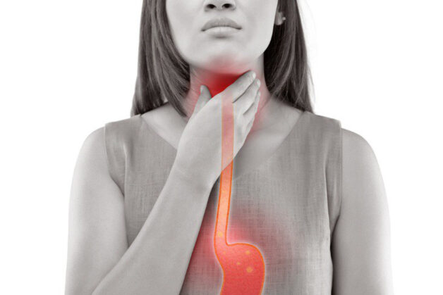 Trào ngược dạ dày thực quản là nguyên nhân chính gây nên viêm hầu họng