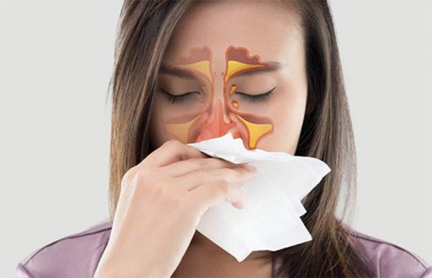 Tuỳ vào từng cấp độ, viêm mũi sẽ có những triệu chứng bệnh khác nhau