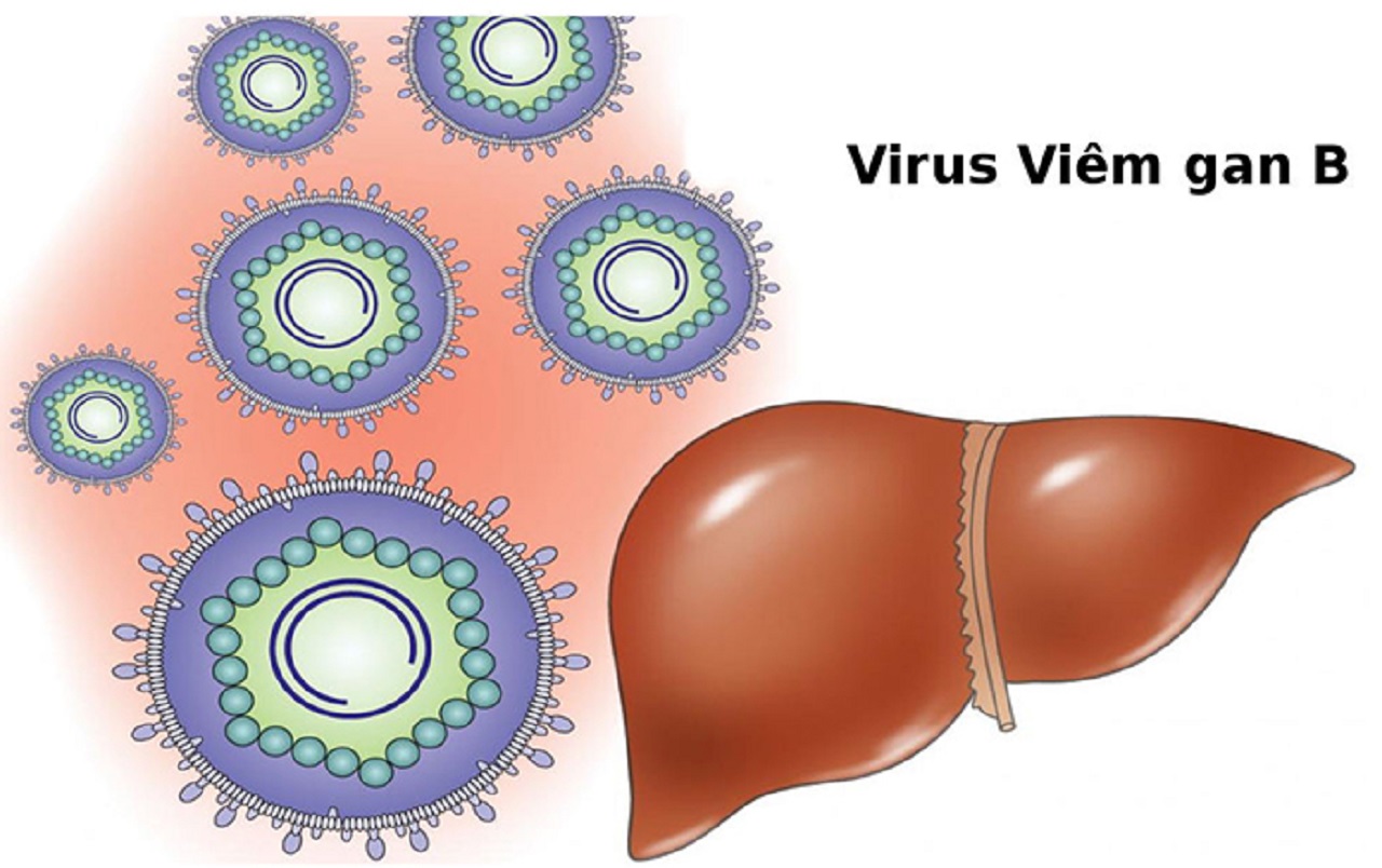 Viêm Gan B Dương Tính Và Học Cách Sống Chung Với Virus Viêm Gan B