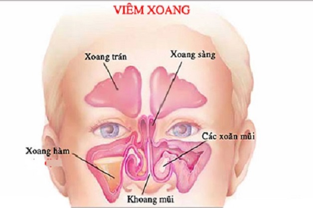 Đau Đầu Ở Thái Dương Bên Trái: Nguyên Nhân, Cách Điều Trị Hiệu Quả Và Phòng Ngừa