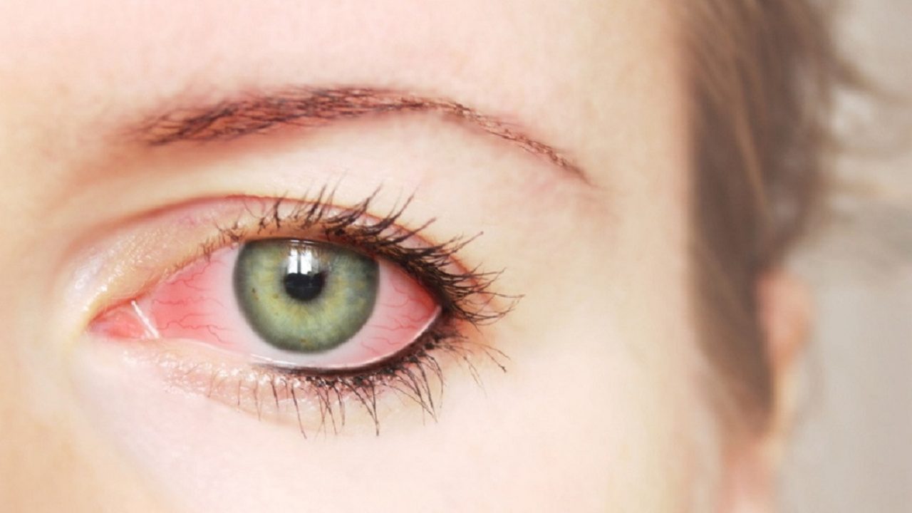 Đau mắt đỏ có ảnh hưởng đến sức khỏe thai nhi không?
