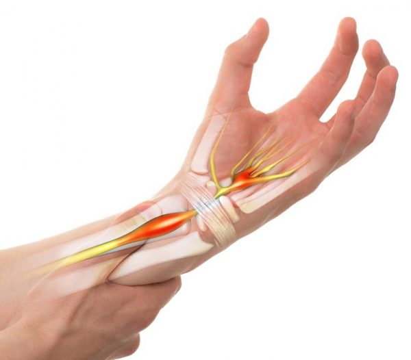 Hội chứng ống cổ tay thường gặp ở những người sử dụng cổ tay nhiều, thường xuyên