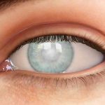 Loạn dưỡng giác mạc nguy hại cho mắt như thế nào?