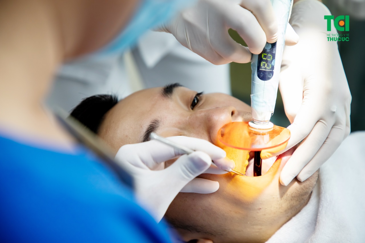  Có cần chuẩn bị gì trước khi nhổ răng cấm bị sâu?
