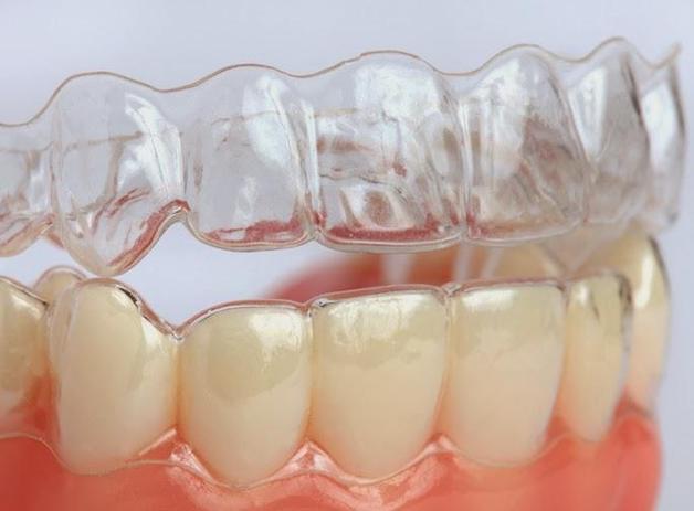 Niềng răng trong suốt sử dụng hệ thống khay niềng trong suốt ôm sát mặt răng nên đảm bảo tính thẩm mỹ