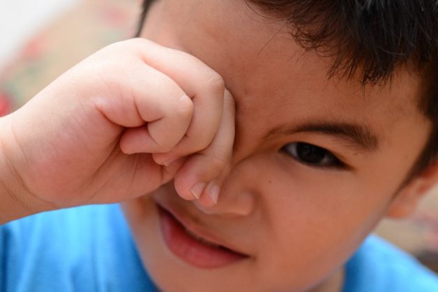 Có nhiều nguyên nhân gây ra bệnh viêm bờ mi mắt ở trẻ nhỏ
