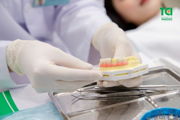 Phương pháp dán răng sứ mang lại hiệu quả về thẩm mỹ cho hàm răng