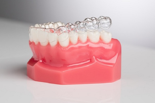 Chi phí niềng răng trong suốt ở mỗi loại khay niềng có sự chênh lệch đáng kể 