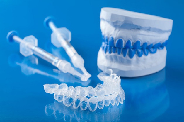 Giá dịch vụ tẩy trắng răng ở mỗi phương pháp có sự chênh lệch đáng kể