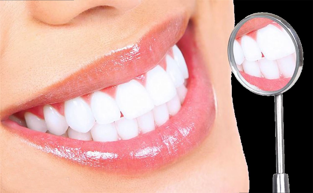 Mua máng tẩy trắng răng ở đâu giá rẻ nhất?
