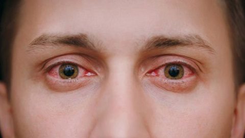 Những triệu chứng đau mắt hột không nên chủ quan