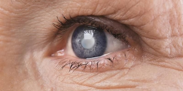 Biến chứng nguy hiểm nhất của đau mắt hột đó là có khả năng dẫn đến mù lòa
