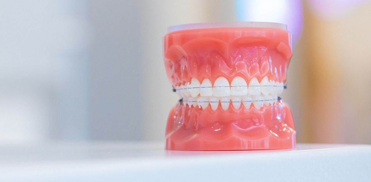 Bác sĩ nha khoa có thể tư vấn về giá niềng răng mắc cài không?
