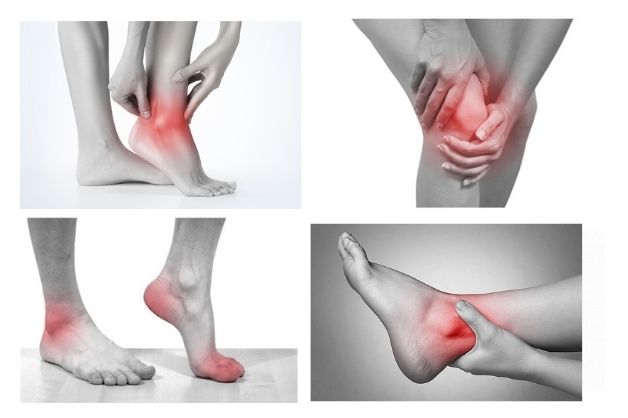 Viêm khớp chân và những triệu chứng thường gặp