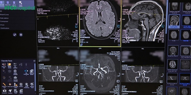 Chụp cộng hưởng từ sọ não (MRI sọ não) - phương pháp chẩn đoán hình ảnh hệ thần kinh